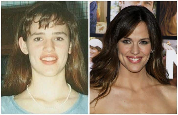 hiressegek regen es most tinedzserkorukban jennifer garner