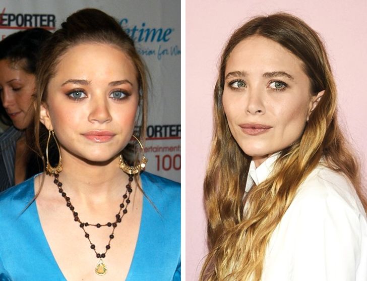 hiressegek plasztikai mutet Mary-Kate Olsen