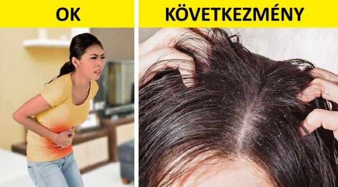 haj egeszseg, haj apolasi tanacsok, haj apolasi tippek, egeszsegtelen haj7