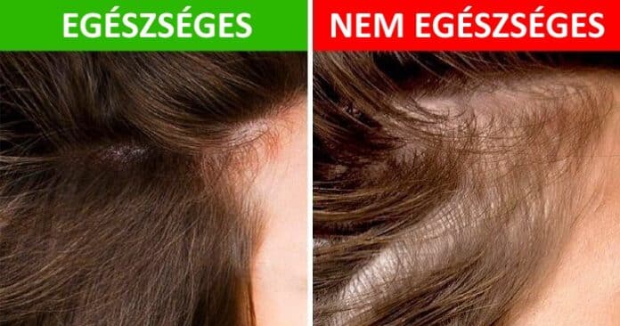 haj egeszseg, haj apolasi tanacsok, haj apolasi tippek, egeszsegtelen haj5