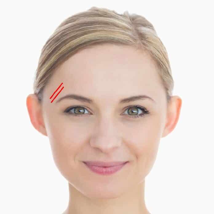 arcbor egeszseg, arcbor rancainak jelentse, arcbor, rancok jelei, miert vannak arcbor rancok16