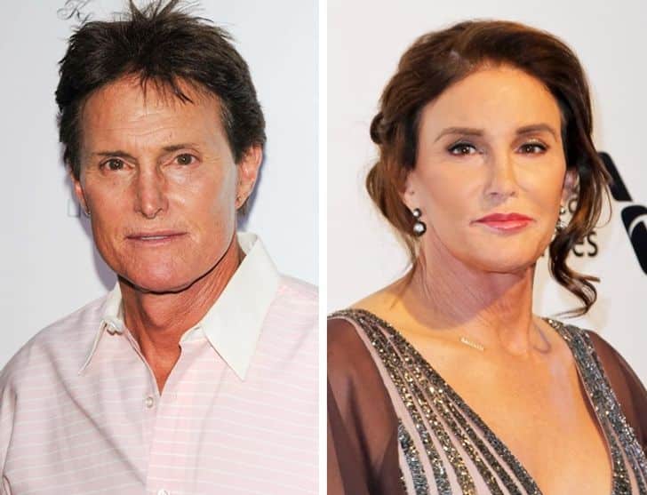 hiressegek plasztikai mutet caitlyn jenner