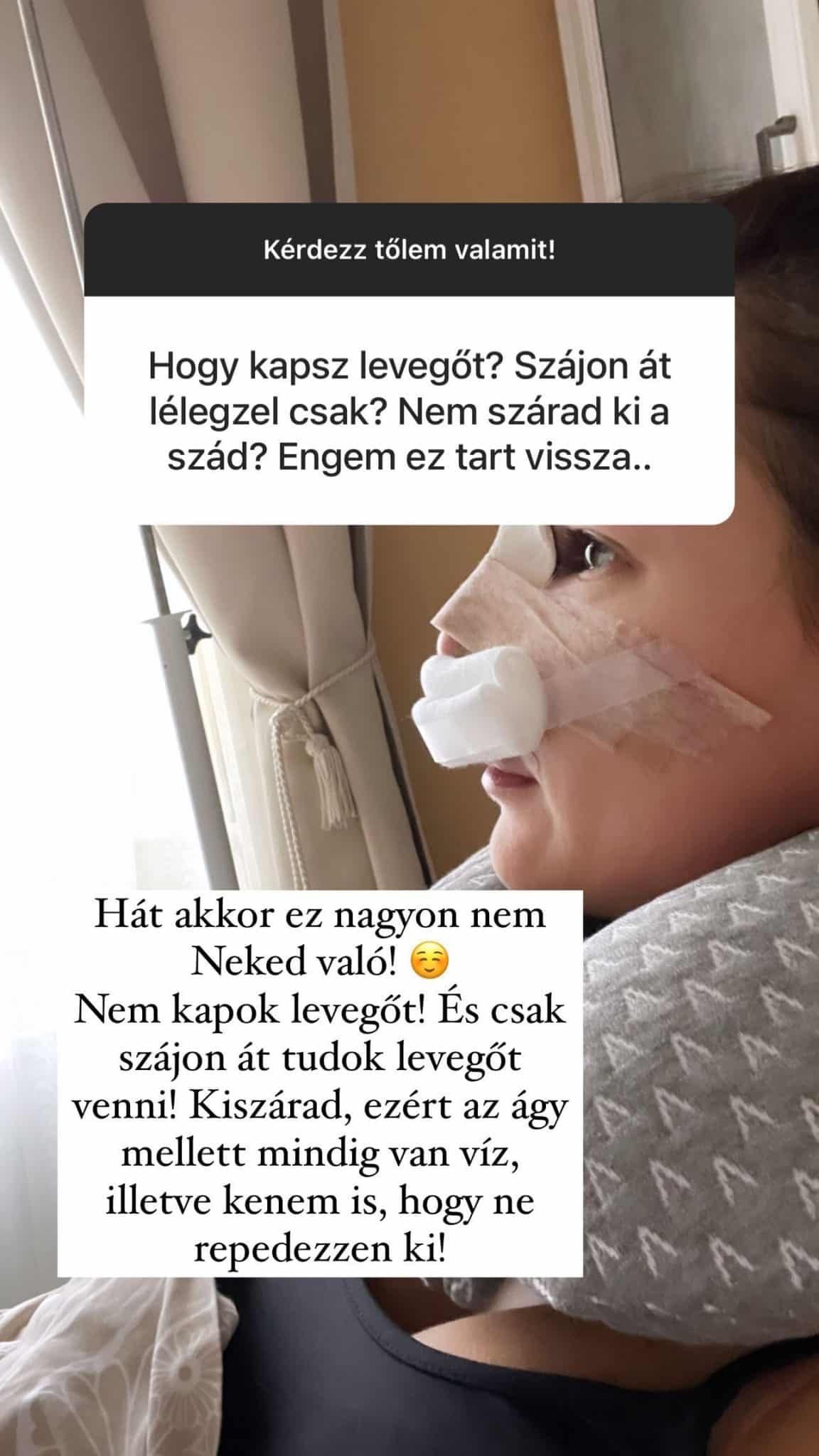 nadai aniko orrplasztika instagram