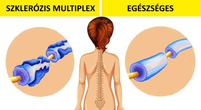 napi 2 csesze kave egeszseges, a kave egeszseges, tovabb elsz a kavetol 6