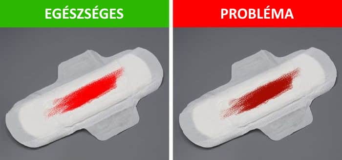egeszsegugy, problema, noi problema, jel 3