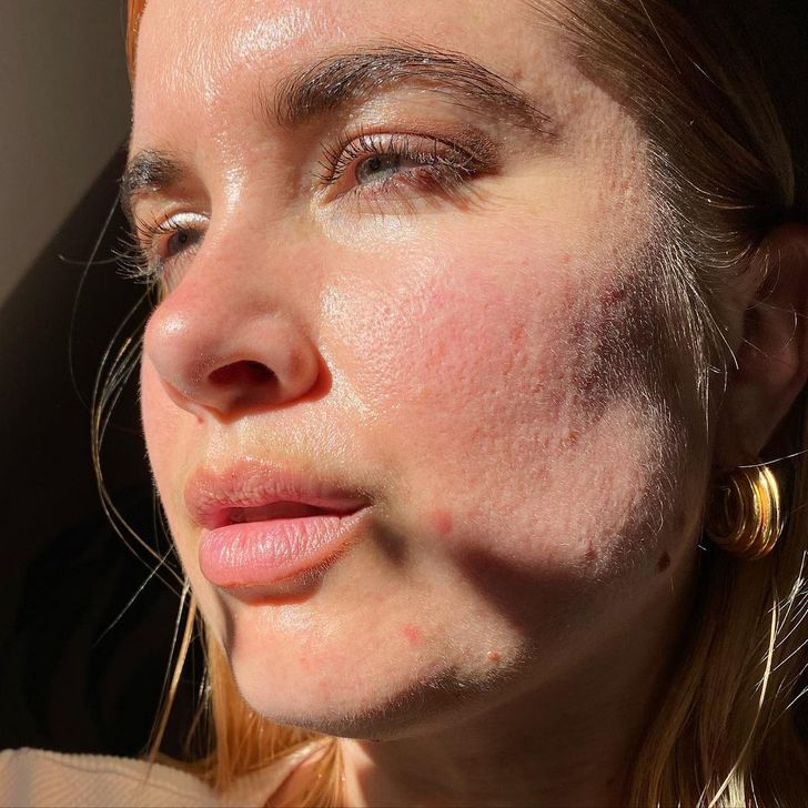 Joanna Kenny a filterek negatív hatására és az önelfogadására hívja fel a figyelmet platformján / Fotó: Joanna Kenny Instagram oldala