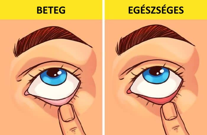 egeszseg ellenorzes, egeszseg, egeszseges eletmod, 5