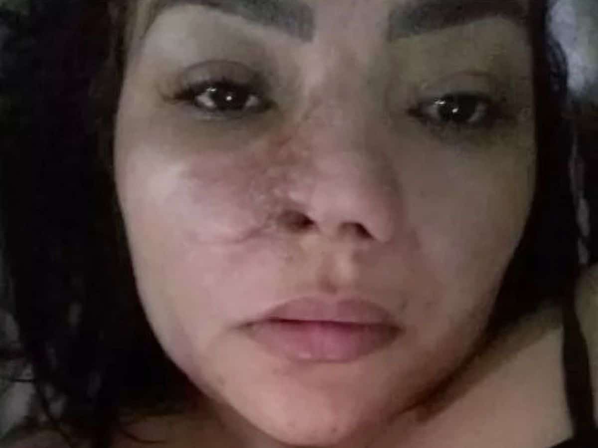 Elielma Carvalho Braga nekrozis orvosi hiba Soares Nascimento fogorvos