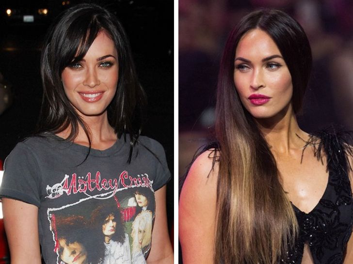 hiressegek plasztikai mutet Megan Fox