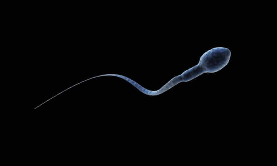 tulnepesedes shanna swan spermiumszam meddoseg
