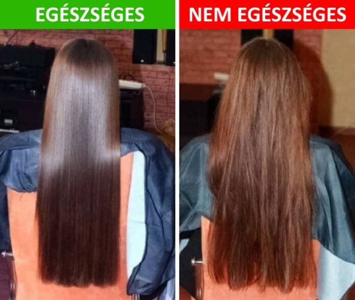 haj egeszseg, haj apolasi tanacsok, haj apolasi tippek, egeszsegtelen haj8