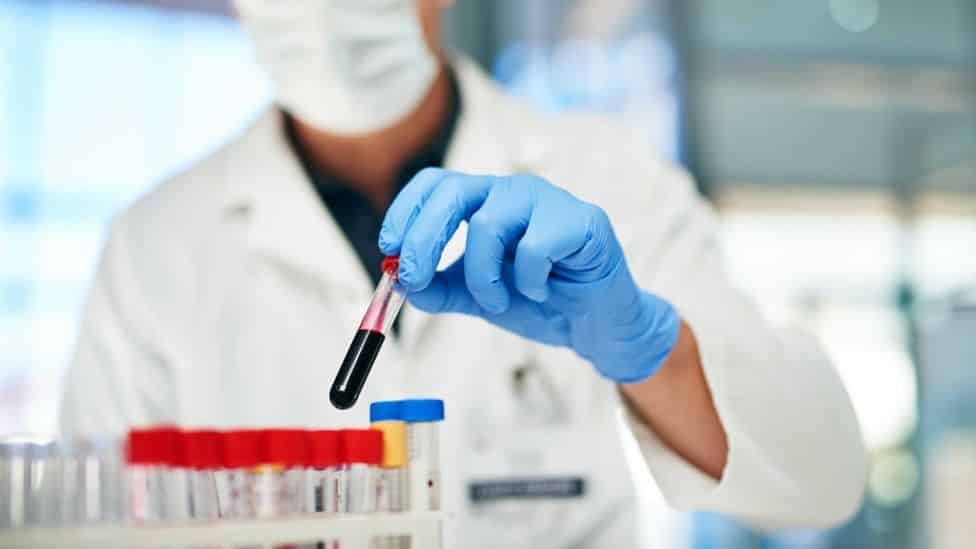 galleri-teszt nhs rakmegelozes diagnosztika