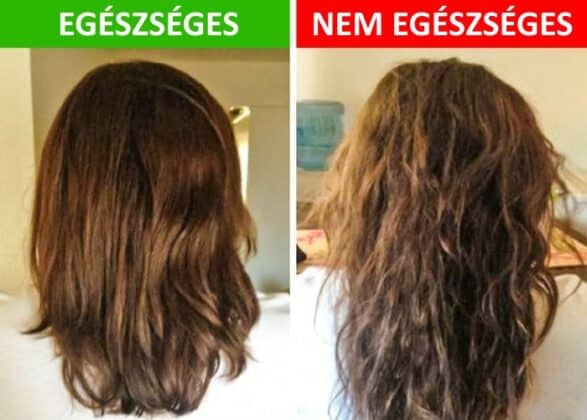 haj egeszseg, haj apolasi tanacsok, haj apolasi tippek, egeszsegtelen haj1