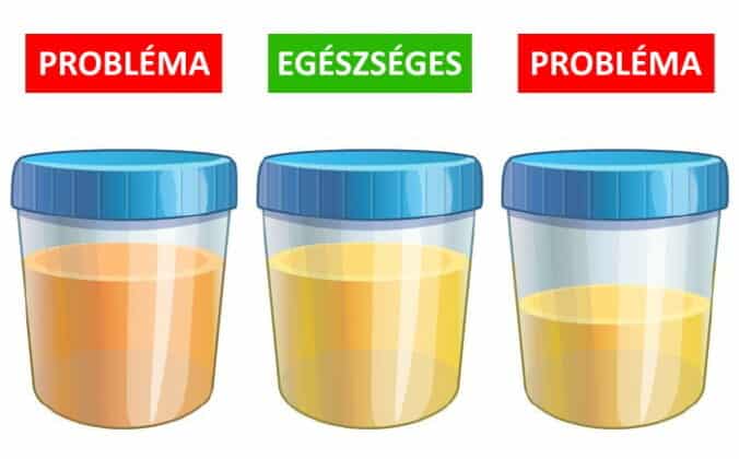 veseko jelei, vesekore figyelmezeto jelek 1