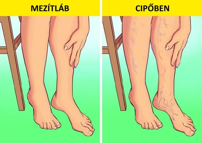 mezitlab, tobbet kene mezitlab jarnod, zokni nelkul, egeszsegesebb mezitlab