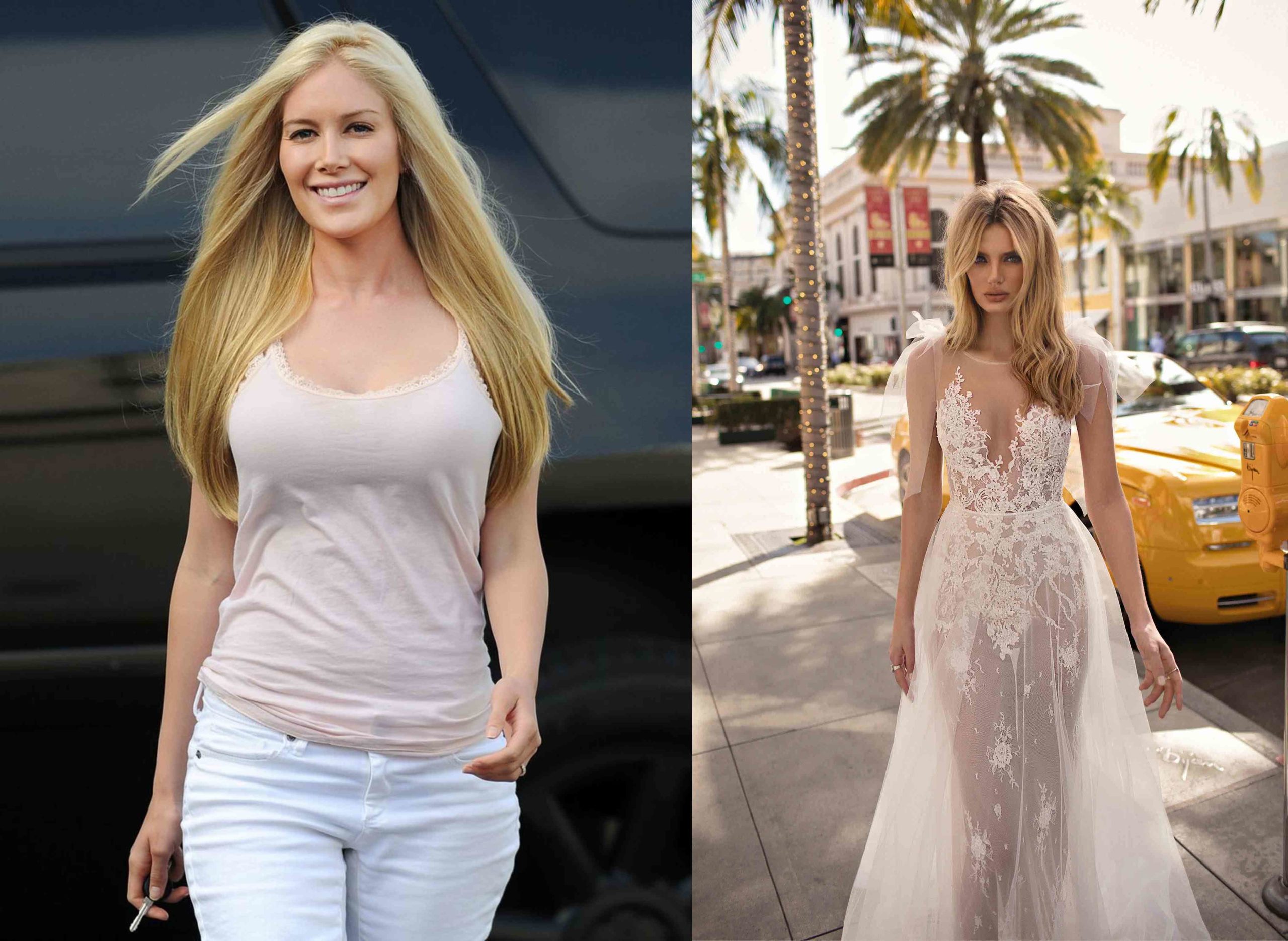 heidi montag surgery scaled