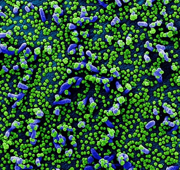 koronavirus emberi sejt tunetei
