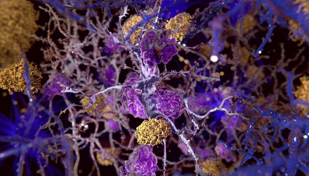 alzheimer agysejtek agykutatas