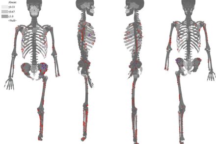Cápatámadás 3000 évvel ezelőtti áldozatának maradványait találták meg