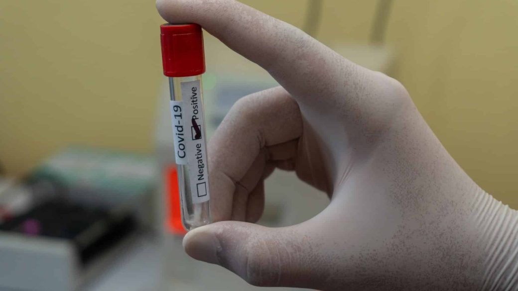 koronavirus teszteles franciaorszag