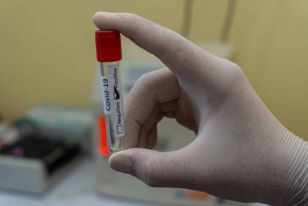 A francia kormány a koronavírus-tesztek fizetőssé tételét fontolgatja