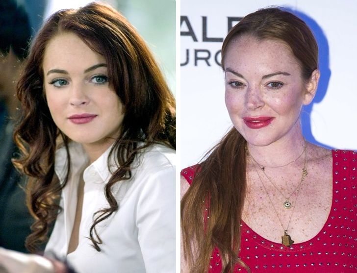 hiressegek plasztikai mutet Lindsay Lohan