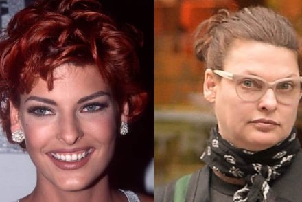 A szupermodell Linda Evangelista alakját végleg tönkretette a zsírleszívás