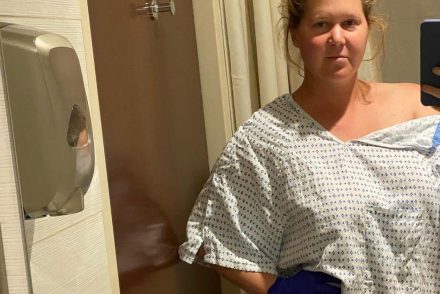 Amy Schumer elvesztette a méhét és a vakbelét az endometriózis miatt