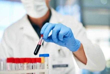 Nagy-Britanniában már önkénteseken vizsgálják a rákdiagnosztikában mérföldkövet jelentő Galleri-tesztet