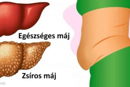 6 figyelmeztető jel, hogy a májad tele van méreganyagokkal