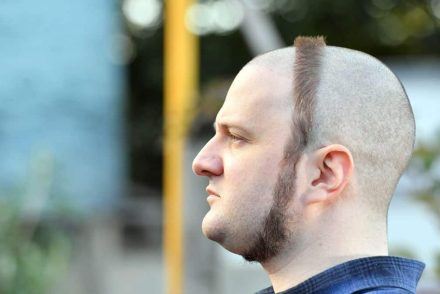 Meglepően nemes céllal hordja a különc frizurát, rákos gyerekeknek gyűjtött vele