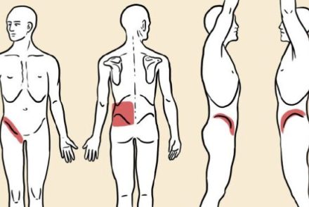 5 vesekőre figyelmeztető jel, amire érdemes lehet odafigyelni