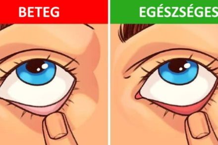 9 egyszerű teszt, melyekkel gyorsan ellenőrizheted az egészségedet