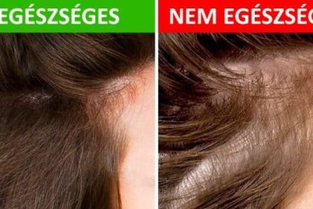 8 dolog, amit a hajad elárulhat az egészségedről