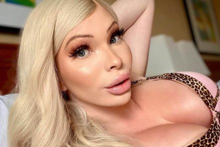 21 millió forintot költött plasztikai műtétekre, hogy a leghűebb Barbie babává váljon
