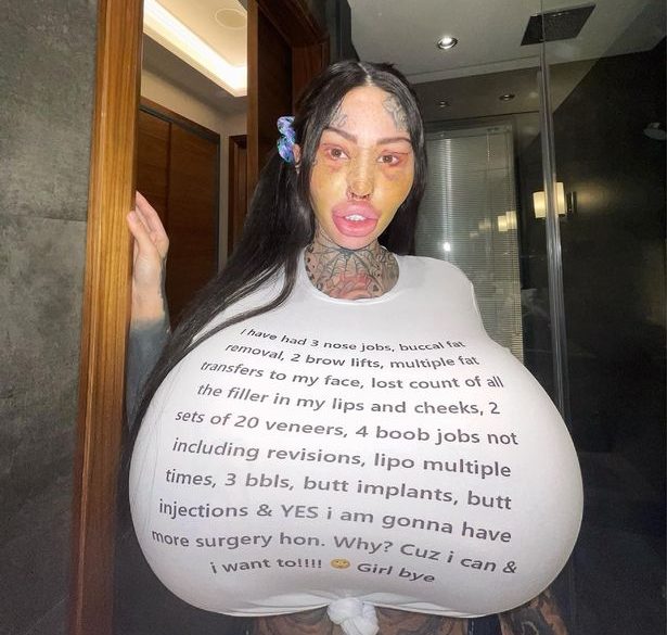 only-fans-sztar-legkoverebb-vagina-mutetek-kovetkezo-beavatkozasok