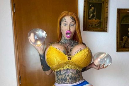 Az OnlyFans „legkövérebb vaginájú” sztárja megmutatta, hogyan nézett ki az operáció előtt