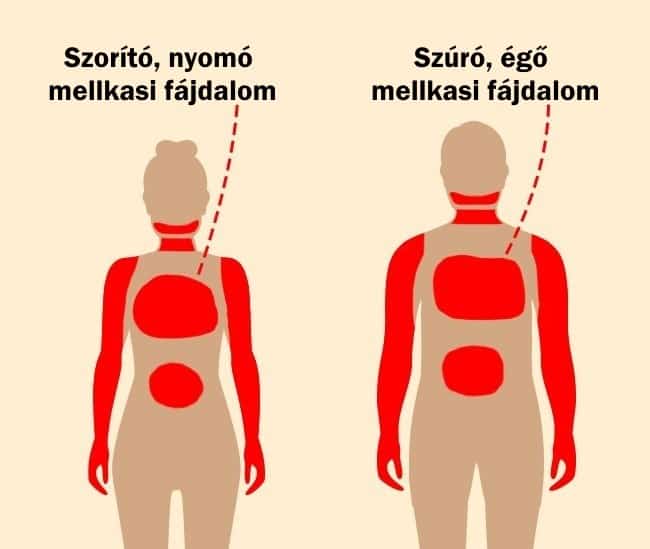 Szívroham: ezek a korai, furcsa tünetek is jelezhetik az orvosok szerint - EgészségKalauz
