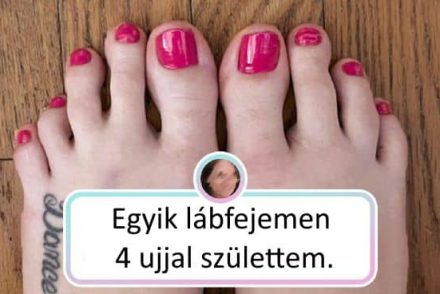 8 különleges ember, akit megáldott az anyatermészet