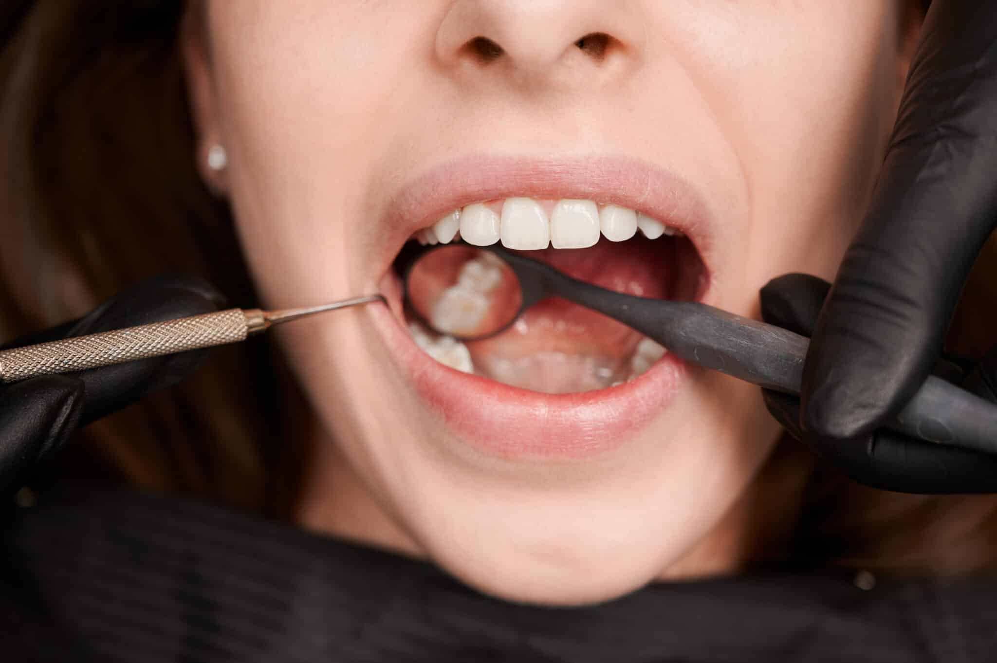 Macro photography of a beautiful female smile with white healthy teeth