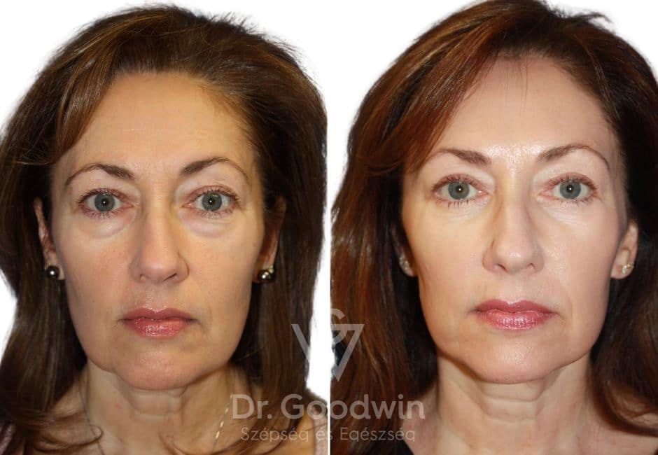 xr:d:DAFOF0UCyCc:131,j:37606192743,t:22101015