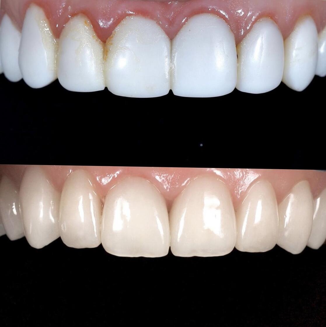 www.smileharmony.hu - 2026 április - LinkMarketing - 2